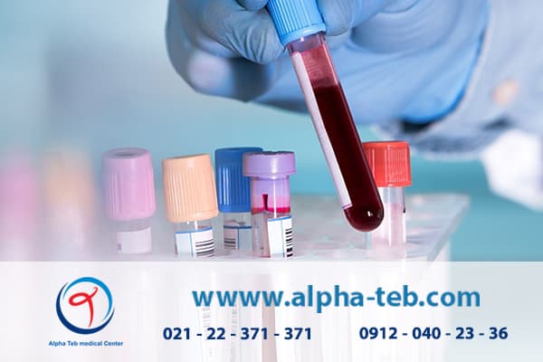 آزمایش خون در منزل در کمال آسایش و راحتی با آلفاطب