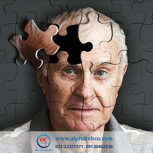 پرستار بیمار آلزایمری - تعریف آلزایمر