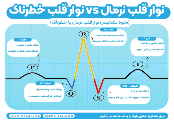 تشخیص نوار قلب نرمال و خطرناک