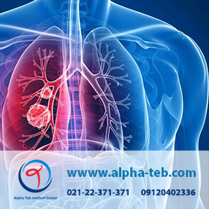 آلرژی ریه و حساسیت تنفسی