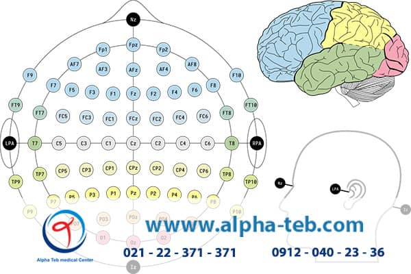 نوار مغزی و نقشه مغزی با هم چه تفاوتی دارند؟