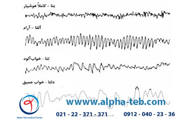 تفسیر نوار مغز سالم و ناسالم