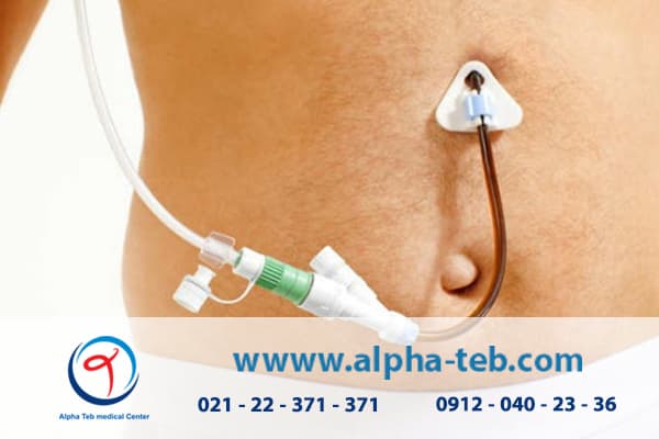 نحوه رزرو خدمات گاواژ در منزل