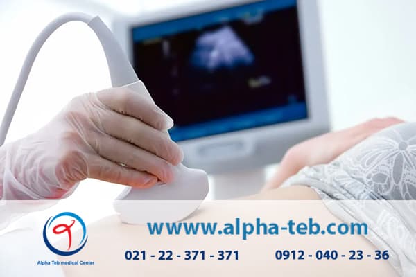 بررسی سونوگرافی برای تشخیص بارداری