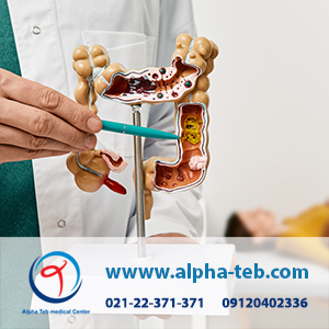 متخصص گوارش در منزل