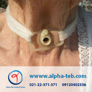تعویض و مراقبت بیمار تراکئوستومی در منزل