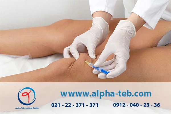 مراحل تزریق ژل زانو در منزل